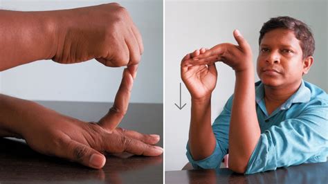 5 Easy Trigger Finger Exercises & Self-Massage Technique