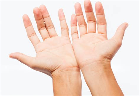 signs      hand pain  problems  hearty soul