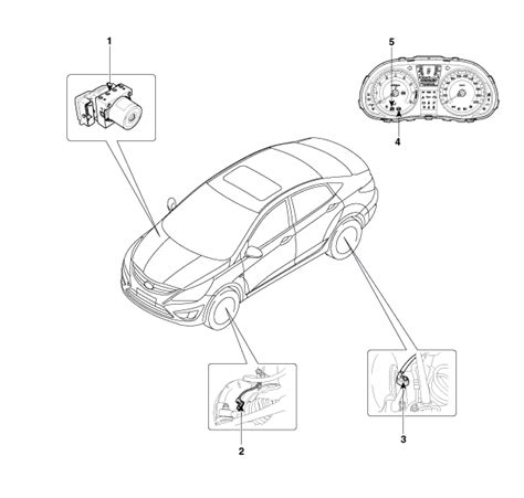 Hyundai Solaris | Компоненты | Хендай Солярис