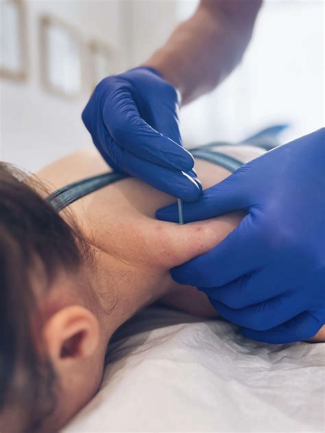 Dry Needle Therapy for Neck Pain
