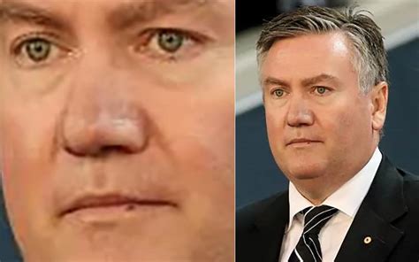 Nation Collectively Laughs At Eddie McGuire : r/australia