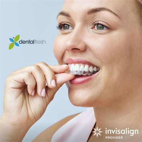 clear aligners worth  dental fresh