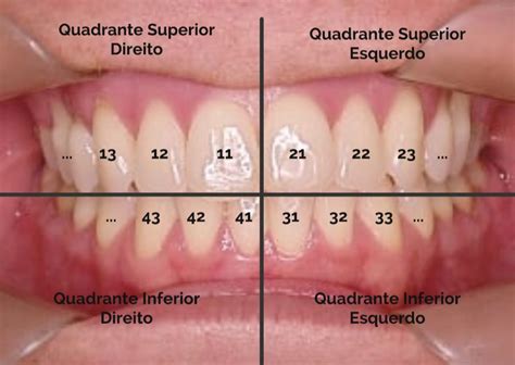 Nomes De Cada Dente - Nome Dos Dentes E Numeração - RETOEDU