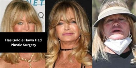 Has Goldie Hawn Had Plastic Surgery