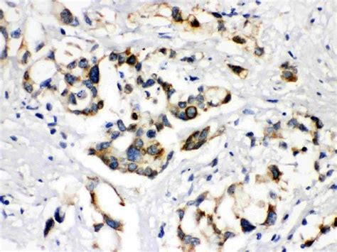 ABCB11 Antibody