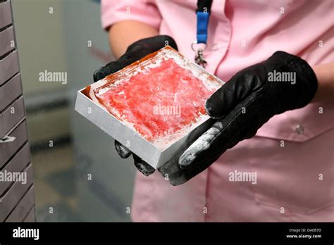 Cord blood hi-res stock photography and images - Alamy