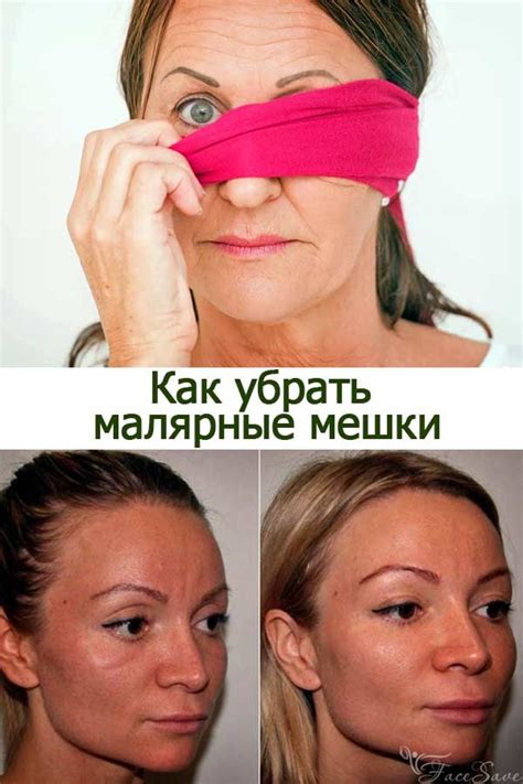 Что такое малярные мешки под глазами и как от них избавиться | Skin, Beauty