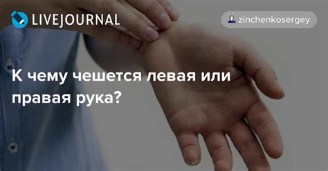 Почему чешется ладонь левой руки у людей, какой зуд к деньгам, левый ...