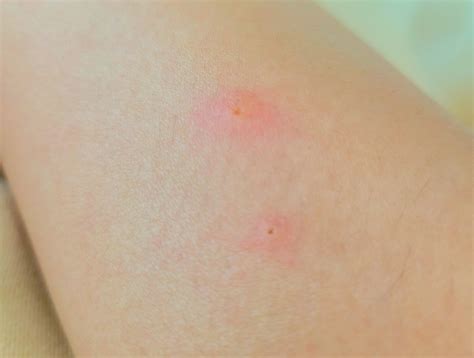 肌のかゆみの原因とは？正しい対処法や皮膚疾患の一例も紹介