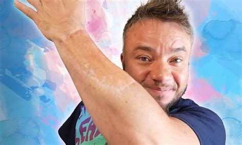 trans men explain  penis surgery changed  lives