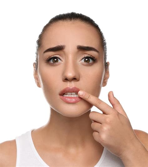 red spots   lips lipstutorialorg