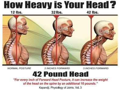 Craniocervical instability surgery is not the only option for cci