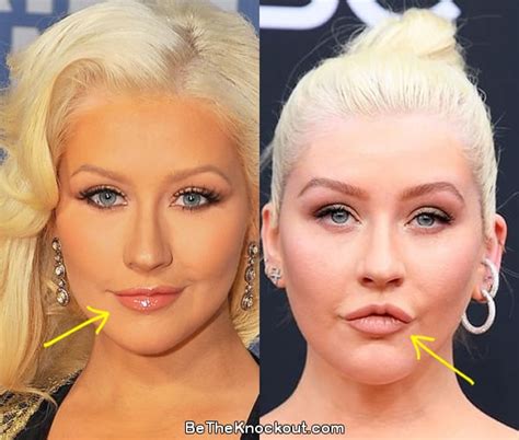 Christina Aguilera Plastic Surgery Comparison Photos