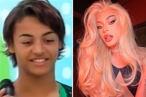 Pablo Antes E Depois - Pablo Antes E Depois - NAZAEDU