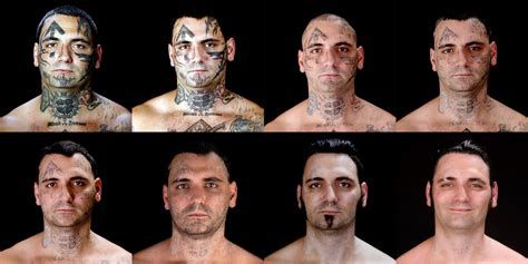 how much to get tattoo removed
