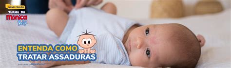 O Que É Bom Para Assadura Em Bebê Caseiro - O que é bom para assadura em bebê? | Novas fraldas Turma da Mônica Baby ...