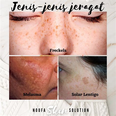 noufaskinco jenis jenis jeragat jeragat