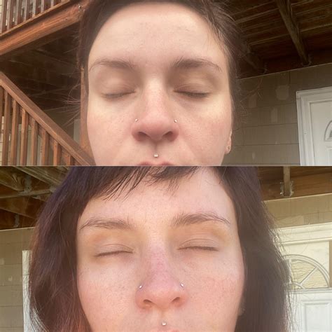 Cigarettes Before And After Face