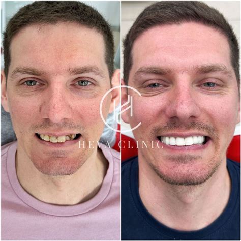 dental treatment    unfiltered results