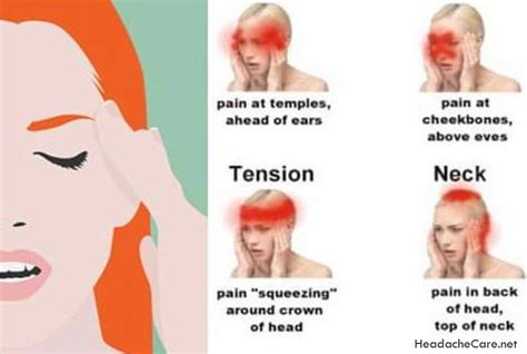 What Are The Symptoms Of A Migraine Headache?