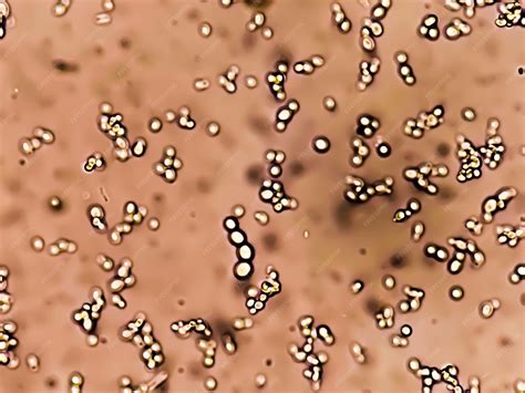 urine culture yeast treatment  jai patrick blog