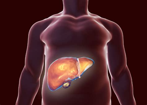 Patient Active Studies | FOMAT