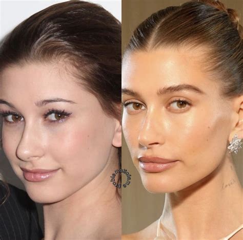 Hailey Bieber Antes E Depois - Así lucía Hailey Bieber antes de las cirugías que dice no se hizo | Es ...