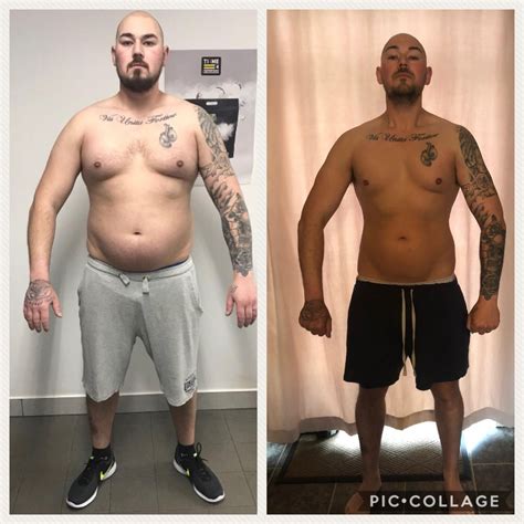 Uneven Chest Muscles