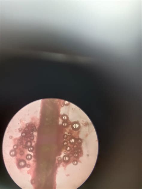 ts  rachis botany notes teachmint