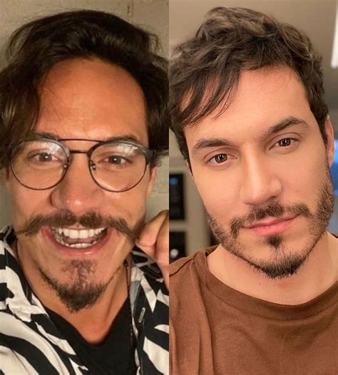 Eliezer Antes E Depois - Eliezer exibe antes e depois de procedimentos estéticos | Celebridades ...