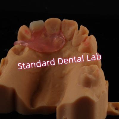 upper valplast unilateral dentures removable flexible  tooth partial