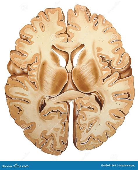 Brain - Cross Section Royalty-Free Stock Photography | CartoonDealer
