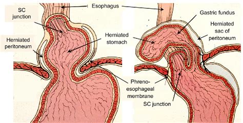 Can Dogs Get Hiatal Hernias