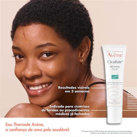 Cicalfate Antes E Depois - Gel Cicatrizante Facial e Corporal Avène Cicalfate+ Scar Gel - Época ...