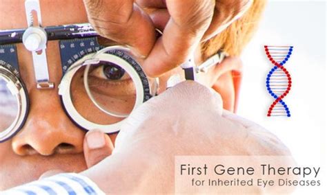 First-Gene-Therapy-for-Inherited-Eye-Diseases