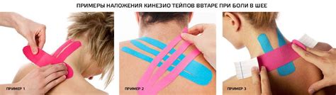 Тейпирование при боли в шее — статьи от эксклюзивного дистрибьютора ...