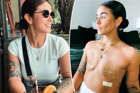Woman explains decision to get double mastectomy at 28