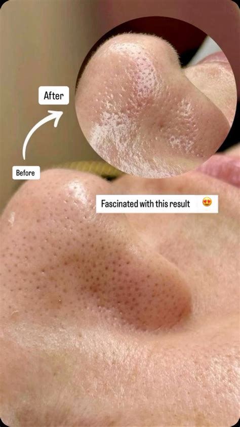 Jose Claudio Baez (@elitehands_) • Instagram photos and videos