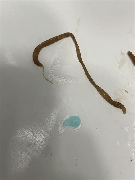 Possible tapeworm? Please help : r/parasites