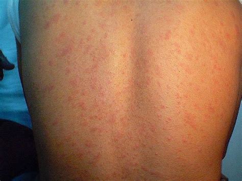 happy holidays    rash shaped   christmas tree
