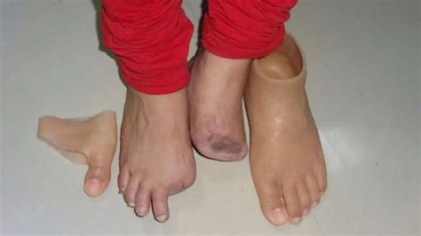 Skin Colour Silicone Silicon Foot Insole at ₹ 30000/piece in Gurugram ...