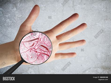 microscopic germs  fingernails