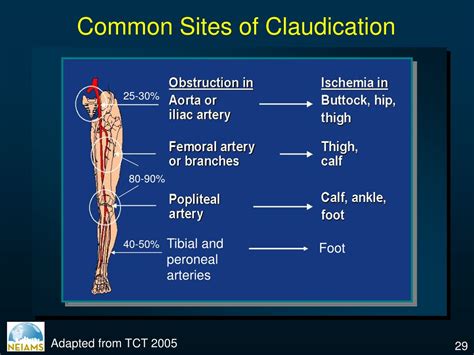 PPT - Peripheral Arterial Disease: Understanding Etiology, Diagnosis