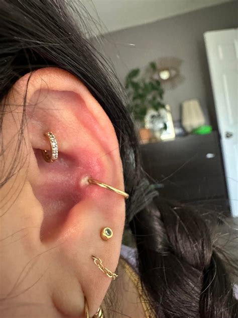 irritation bump? : r/piercing