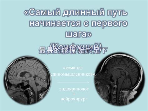 Акромегалия - презентация онлайн