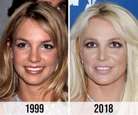 Britney Spears’ Fans Slam Her Alleged Nose Job On Instagram: ‘They Took Away Too Much’ - SHEfinds