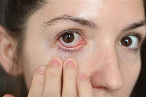 Dry Eye Disease Might Impact Corneal Regeneration | medtigo
