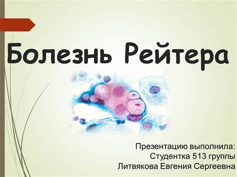 Презентация - Болезнь Рейтера » Привет Студент!