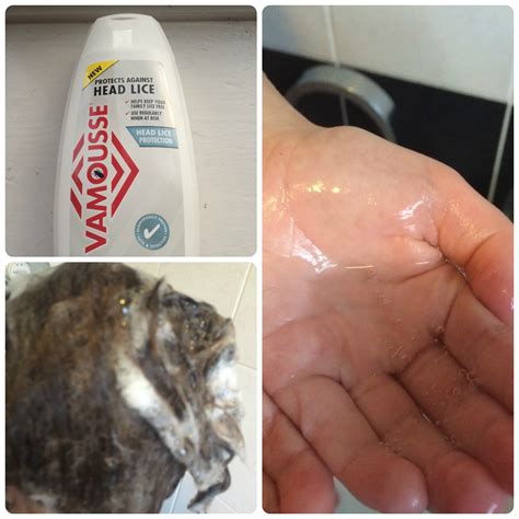 How To Keep Head Lice At Bay - The Life Of Spicers