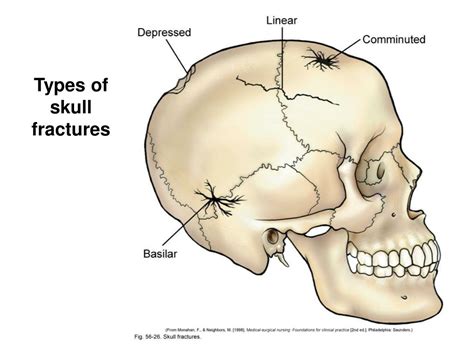 nervous system nervous tissue  brain powerpoint